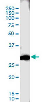 CTLA4 monoclonal antibody (M11), clone 5C12