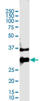 CTLA4 monoclonal antibody (M09), clone 2C8