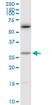 CTF1 purified MaxPab rabbit polyclonal antibody (D01P)