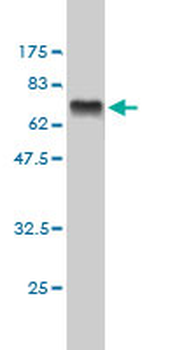 CTBP1 monoclonal antibody (M01), clone 2G7