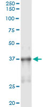 NKX2-5 monoclonal antibody (M05), clone 4B11
