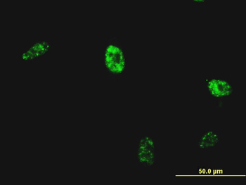 NKX2-5 monoclonal antibody (M04), clone 3C1