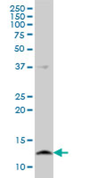 CSTB monoclonal antibody (M02), clone M2-F1
