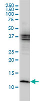 CSTB monoclonal antibody (M01), clone M1-C1