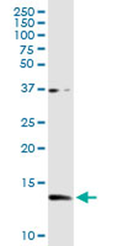 CSTB purified MaxPab rabbit polyclonal antibody (D01P)