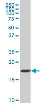 CSRP1 polyclonal antibody (A01)