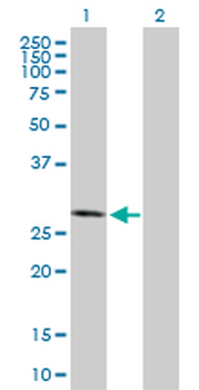 CSNK2B purified MaxPab mouse polyclonal antibody (B01P)