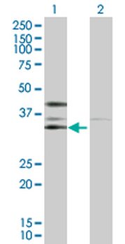 CSNK2A2 purified MaxPab rabbit polyclonal antibody (D01P)