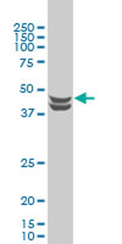 CSNK2A1 monoclonal antibody (M01), clone 3D9