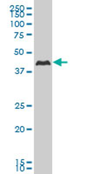 CSNK1G2 monoclonal antibody (M02), clone 2E6