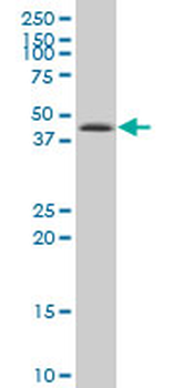 CSNK1D polyclonal antibody (A01)