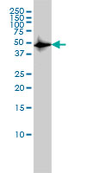 CSK monoclonal antibody (M01), clone 3A3