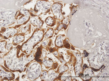 CSH2 purified MaxPab mouse polyclonal antibody (B02P)