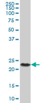 CSH2 purified MaxPab mouse polyclonal antibody (B01P)