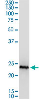 CSH1 MaxPab mouse polyclonal antibody (B01P)