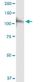 CSF3R MaxPab rabbit polyclonal antibody (D01)