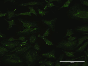 CSF3 MaxPab rabbit polyclonal antibody (D01)