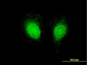 CSF2 purified MaxPab mouse polyclonal antibody (B01P)
