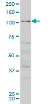 CSF1R monoclonal antibody (M02), clone 3G12