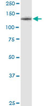 CSF1R monoclonal antibody (M01), clone 1G4