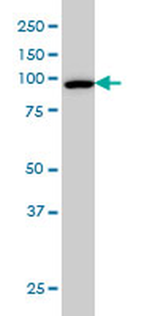 CSE1L monoclonal antibody (M08), clone 3D8