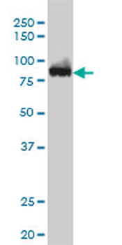 CSE1L monoclonal antibody (M05), clone 3F8
