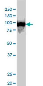 CSE1L monoclonal antibody (M04), clone 2F4