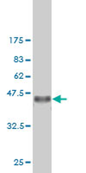 CSE1L monoclonal antibody (M03), clone 2C10