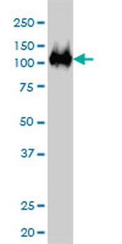 CSE1L monoclonal antibody (M02), clone 1E4