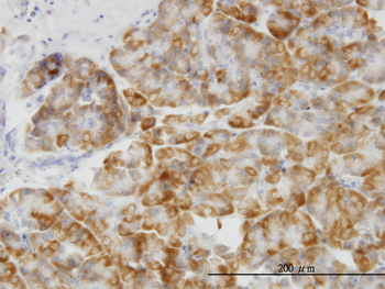 MAPK14 monoclonal antibody (M01), clone 3D5