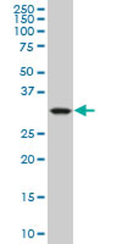CRYM monoclonal antibody (M09), clone 1C6