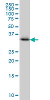 CRYM monoclonal antibody (M03), clone 6B3