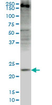CRYGD monoclonal antibody (M03), clone 4E12
