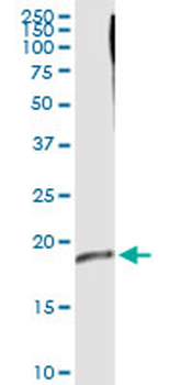 CRYGD MaxPab rabbit polyclonal antibody (D01)