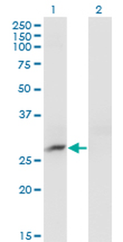 CRYBB3 monoclonal antibody (M01), clone 4H6