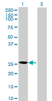 CRYBB3 MaxPab mouse polyclonal antibody (B01P)