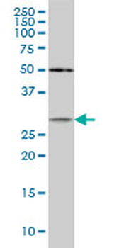 CRYBB1 monoclonal antibody (M03), clone 3D9