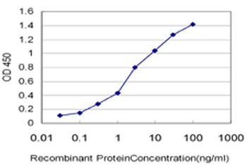 CRYBB1 monoclonal antibody (M01), clone 2B2