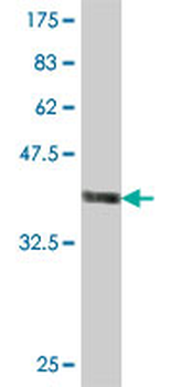 CRYBB1 polyclonal antibody (A01)