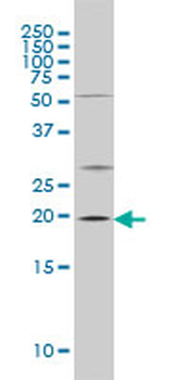 CRYAB monoclonal antibody (M01), clone 1A10-1A4