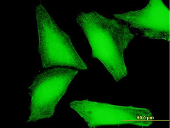 CRY2 purified MaxPab mouse polyclonal antibody (B01P)