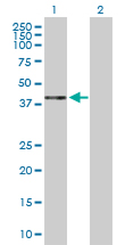 HAPLN1 purified MaxPab rabbit polyclonal antibody (D01P)