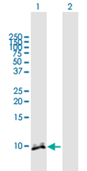 CRP purified MaxPab mouse polyclonal antibody (B02P)