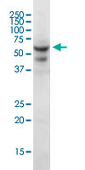 CRAT polyclonal antibody (A01)