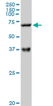 CPT2 purified MaxPab rabbit polyclonal antibody (D01P)