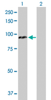 CPT1A purified MaxPab rabbit polyclonal antibody (D01P)