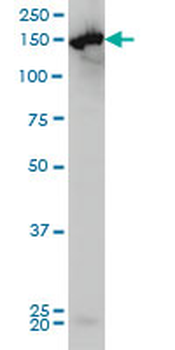 CPS1 monoclonal antibody (M01), clone 8H8