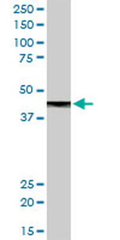 CPB1 MaxPab rabbit polyclonal antibody (D01)