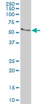 COX15 polyclonal antibody (A01)