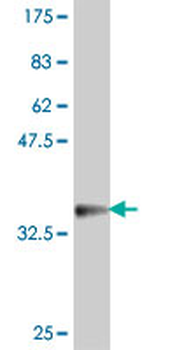 COL19A1 polyclonal antibody (A01)
